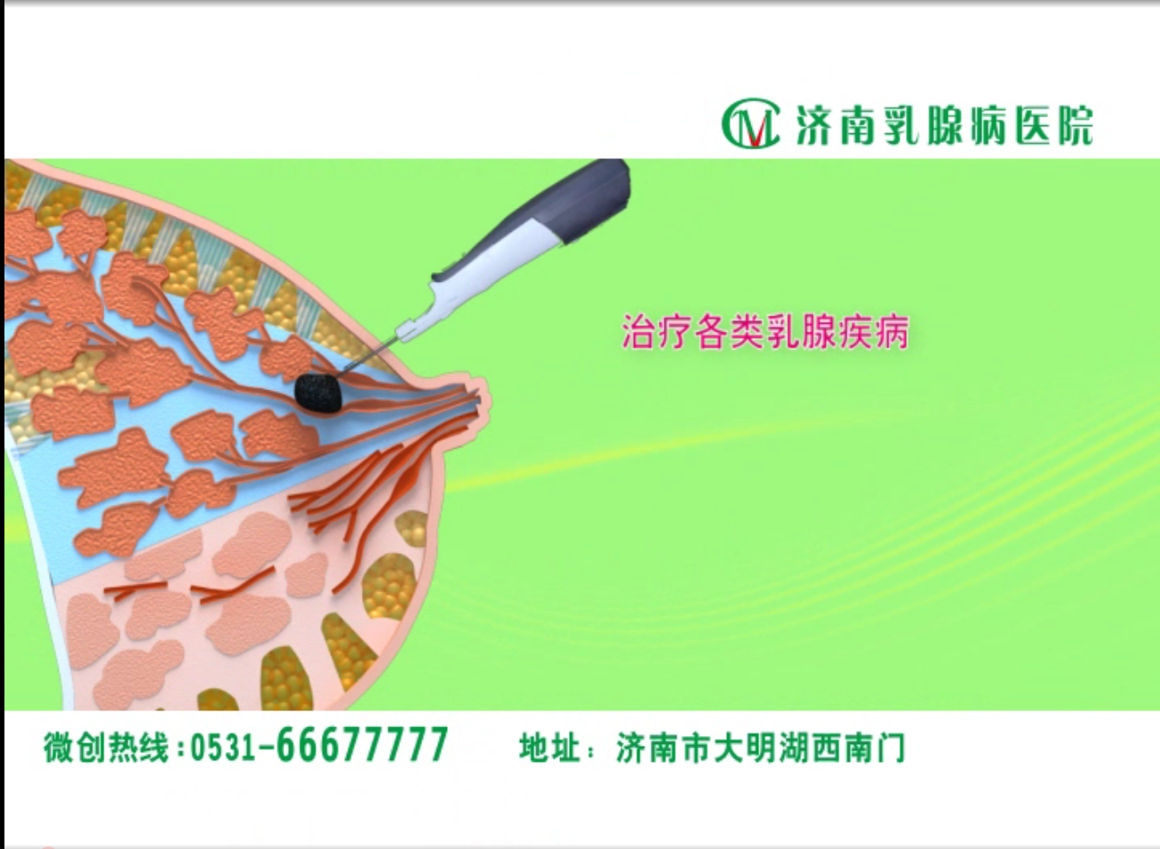 動(dòng)畫視頻是提高患者參與度的好方法